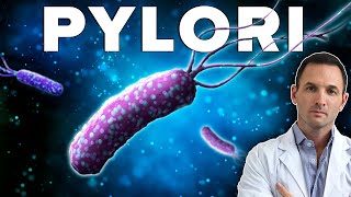 El Helicobacter Pylori Puede Estar Detrás de Tu Dolor de Espalda [upl. by Eojyllib557]