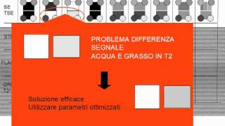 Semeiotica del segnale in risonanza magnetica 37 [upl. by Sinylg]