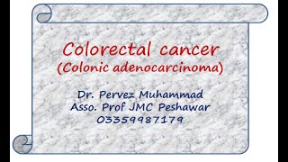 Colon cancer by dr pervez [upl. by Nolyar]