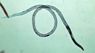 Study of Life Stages of Meloidogyne Rotylenchulus and Radopholus [upl. by Eicyak]