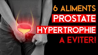 6 Aliments À ÉVITER pour une PROSTATE HYPERTROPHIÉ [upl. by Pasia]