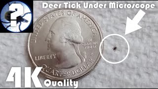 Deer Tick Underneath Microscope In 4K • Detailed Pictures [upl. by Rehtae]