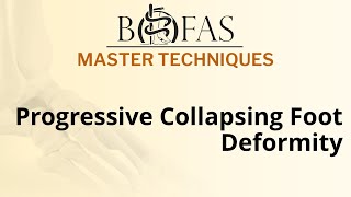 Progressive Collapsing Flatfoot Deformity  BOFAS Master Techniques [upl. by Romeyn]