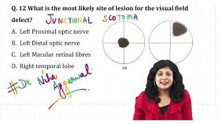 Junctional Scotoma  Dr Niha Aggarwal [upl. by Short]