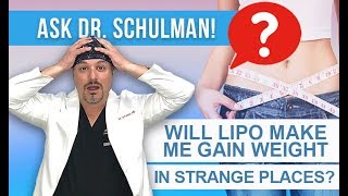 Does Liposuction Make You Gain Weight In Strange Places  Schulman Plastic Surgery [upl. by Branca]