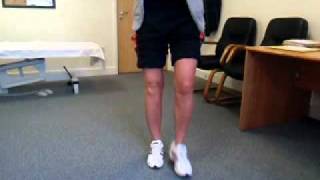 Walking 3 weeks after high tibial osteotomy [upl. by Rattray634]