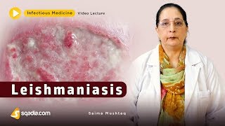 Leishmaniasis  Infectious Clinical Medicine Video  VLearning  sqadiacom [upl. by Jarnagin]