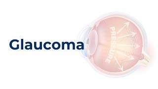 Pharmacology of Glaucoma [upl. by Annaillil]