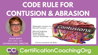 Code Rule for Contusion and Abrasion  CCO Medical Coding Tips [upl. by Moran51]