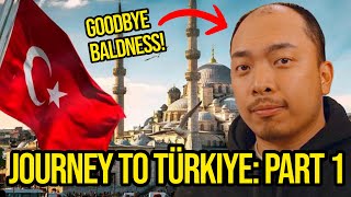 I traveled to Turkiye for a Hair Transplant [upl. by Eppesiug]