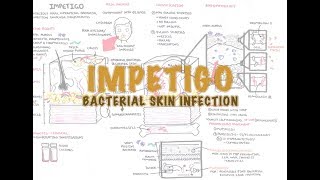 Impetigo Bacterial Skin Infection  Overview Clinical Presentation Pathophysiology Treatment [upl. by Enirhtac170]