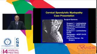 Surgery is Appropriate for Cervical Spondylotic Myelopathy [upl. by Ranjiv41]