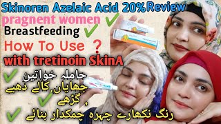 Skinoren Cream20Azelaic Acid Review How To Use Azelaic Acid With TretinoinSkinA Cream Retinoid [upl. by Dyoll]