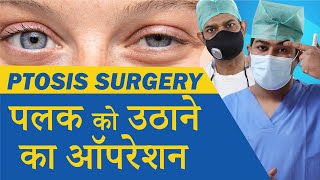 Ptosis Treatment  Droopy Eyelid Treatment  Oculoplastic Surgery for Ptosis at Eye7 Eye Hospitals [upl. by Naic322]