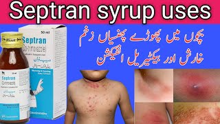 Septran syrup uses in Urduseptran syrupbacterial infection co trimoxazole [upl. by Ahsikin]