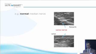 Terasons MSK Ultrasound Basics with Dr Visco Part 5 of 8 [upl. by Latsyc187]