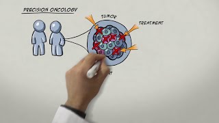 Chasing Metastatic Cancer Cells [upl. by Koffman]