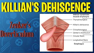 Killians Dehiscence Zenkers Diverticulum head anatomy anatomy mbbs viral youtube shorts [upl. by Emarie975]