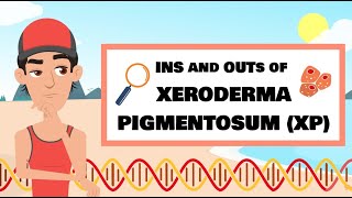 The Ins and Outs of XP Xeroderma pigmentosum [upl. by Ttezzil685]