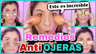 TRUCOS Y REMEDIOS CASEROS PARA ELIMINAR LAS OJERAS  ELIMINAR OJERAS EN CASA  NatyGloss [upl. by Sutsuj]