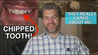 quotTHEY REALLY CARED ABOUT MEquot Chipped Tooth Repair [upl. by Ellenoj]