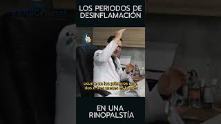 Ciclo de desinflamación en una Rinoplastia  PlasticFacial MX [upl. by Leoine]