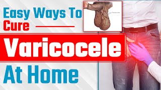 Easy Ways To Cure a Varicocele At Home  अपने वैरीकोसेल को Reverse कैसे करे  Dr Health [upl. by Javier]