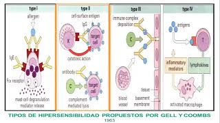 HIPERSENSIBILIDAD TIPO 2 RENE HADDAD [upl. by Tadashi]