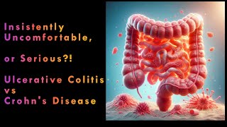 Ulcerative Colitis vs Crohns Disease [upl. by Bennie]