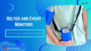 Holter and Event Monitors Procedure Uses and Results [upl. by Nedia]