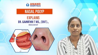 Understanding Nasal Polyps Causes Symptoms and Treatment  Dr Gaayathri [upl. by Ientruoc]