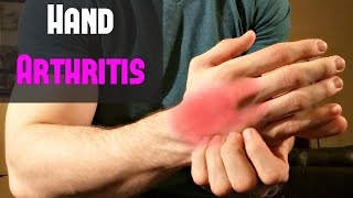 Fast Treatment for Hand Arthritis  Self Massage [upl. by Cline]