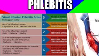 phlebitisthrombophlebitisvip vipscorephlebitisdvt health nidhicreation2012 [upl. by Nisaj]