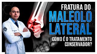 COMO É O TRATAMENTO CONSERVADOR DA FRATURA DO MALÉOLO LATERAL DO TORNOZELO [upl. by Oruhtra]