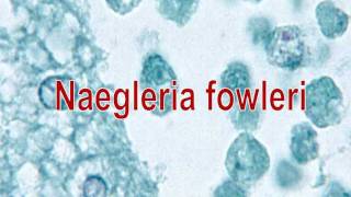 Naegleria fowleri [upl. by Oleusnoc]