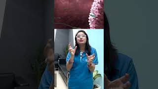 Semen and Sperm  Shorts  NEET Zoology  Medha Joshi  Infinity Learn NEET [upl. by Zetrok]