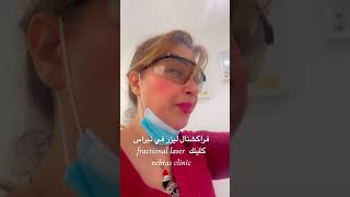 Fractional laser 0044773674170فركشنال ليزر ازالت اثار الجروح، حب الشباب، تصفية البشرة، نبراس كلينك [upl. by Erialc]