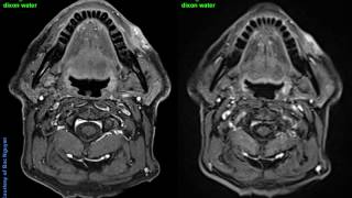 Twist Vibe Head Neck Imaging [upl. by Ardis13]