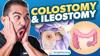 Colostomy and Ileostomy Nursing  Indications Complications Care EASY [upl. by Rivard]