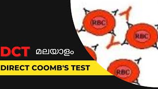 DCTDirect Coombs test മലയാളം [upl. by Yrolam]