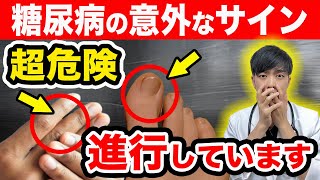 【放置厳禁】知らないと後悔する糖尿病が『進行している』SOSサイン【注意な合併症】初期症状を現役医師が簡単解説します。【アニメーション】 [upl. by Daitzman]