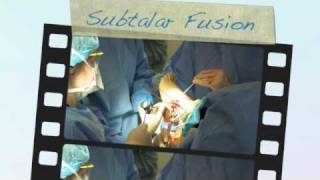 Subtalar Arthrodesis Surgical Technique Joint Exposure using the Tarsal Joint Distractor [upl. by Baugh349]