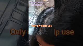 Ozone Treatment For Hair DandruffHair treatmentprofessionalshorthairhighfrequencyozone [upl. by Annawek734]