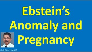 Ebsteins Anomaly and Pregnancy [upl. by Aihsekin874]