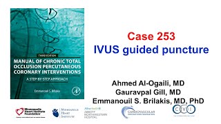 Case 253 Manual of CTO PCI  IVUS guided puncture [upl. by Nnayelhsa]