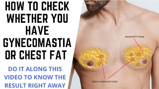 HOW TO KNOW WHETHER YOU HAVE CHEST FAT OR GYNECOMASTIA DO A TEST NOW AS SHOWN IN THIS VIDEOSIMPLE [upl. by Enaffit641]