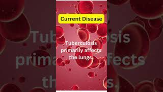 TB Disease can be Cure factfriends shortsfeed viral trending shorts [upl. by Affrica]