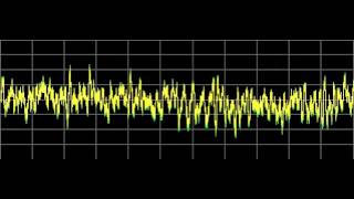 Ascaris Parasite also Ascariasis  Rife Frequencies [upl. by Ronacin]