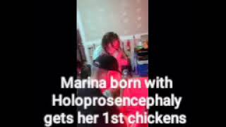 Marina born with Holoprosencephaly loves her chickens [upl. by Orofselet]