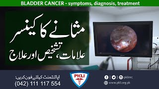 BLADDER CANCER  مثانے کا کینسر [upl. by Nosnirb68]